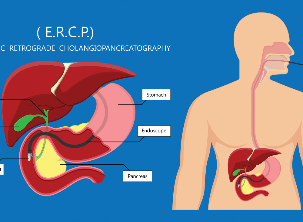 Gastroscopy